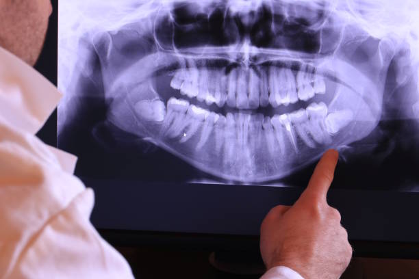 Best Emergency Dental Surgery in Frostburg, MD